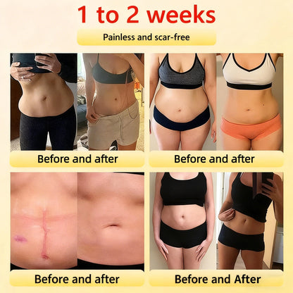 🔥Last day:70% off🏆 Self-regulating tourmaline shaping shorts with titanium fiber