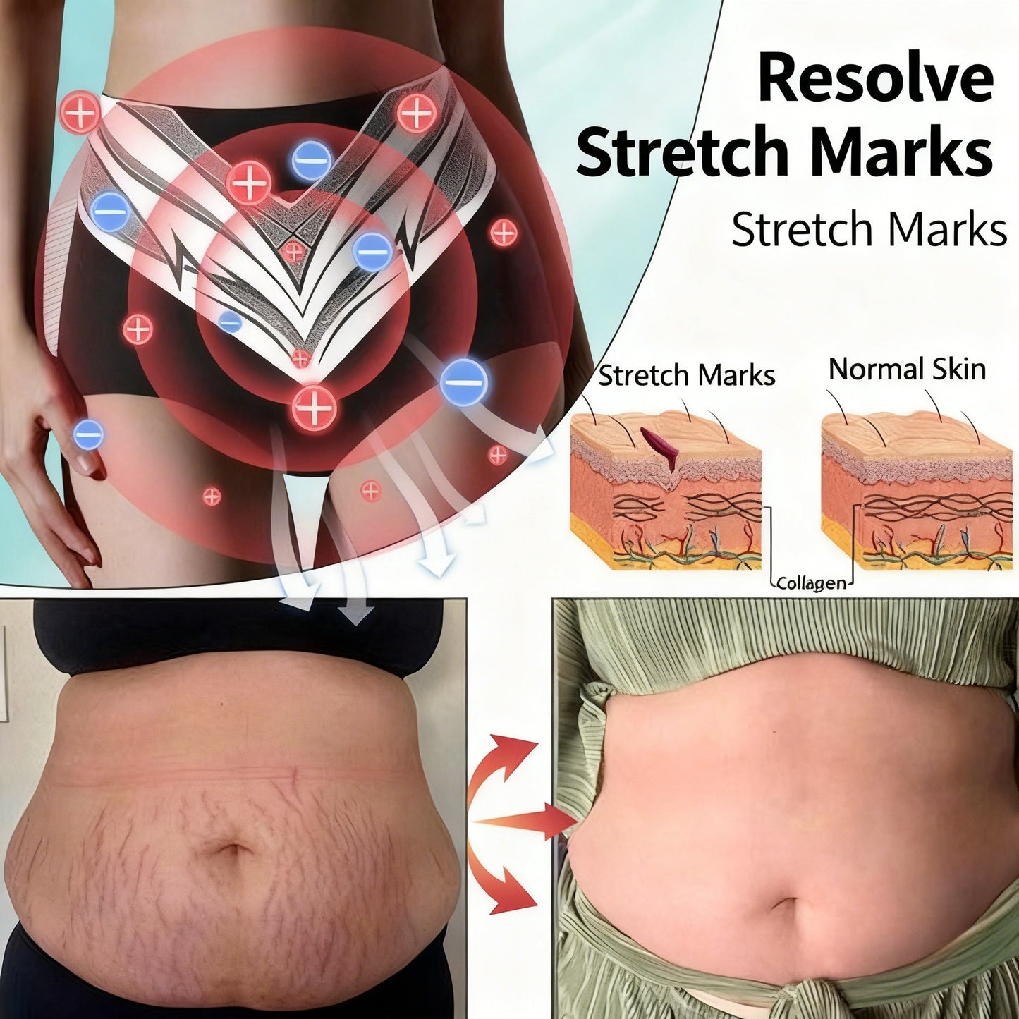 🔥Last day:70% off🏆 Self-regulating tourmaline shaping shorts with titanium fiber