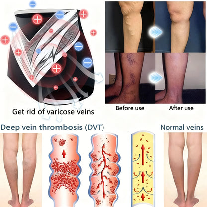 🔥Last day:70% off🏆 Self-regulating tourmaline shaping shorts with titanium fiber