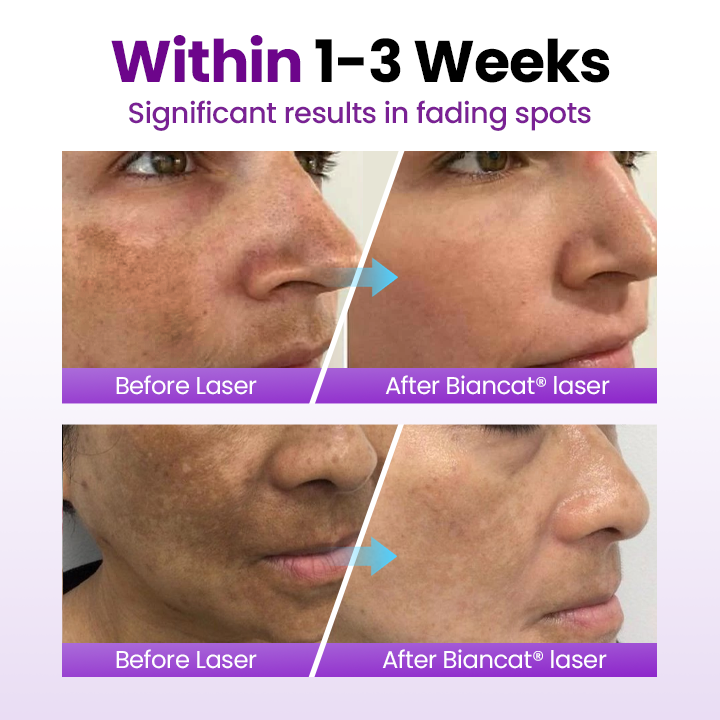 🎅Christmas Hot Sale🔥SpotErase Probiotic Shield Serum