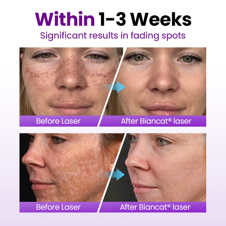 🎅Christmas Hot Sale🔥SpotErase Probiotic Shield Serum