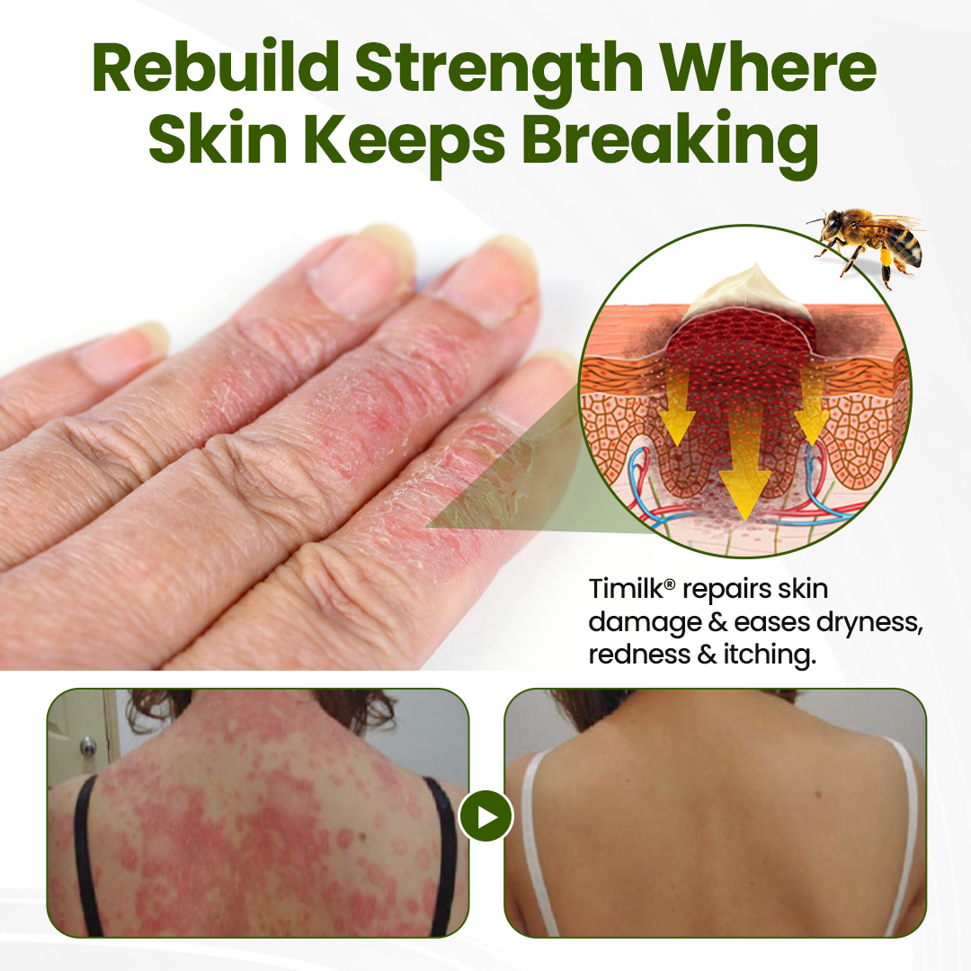 🎅Christmas Hot Sale🔥 BeePeptide RootSoft DualRelief Cream