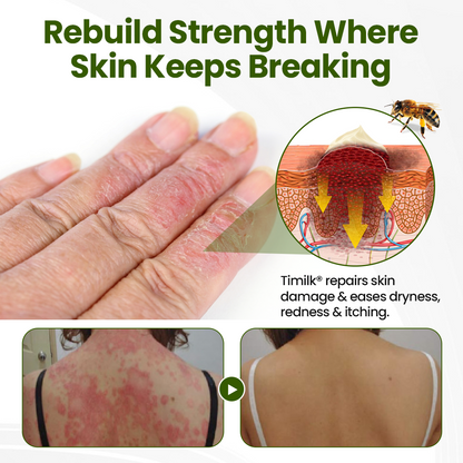 🎅Christmas Hot Sale🔥 BeePeptide RootSoft DualRelief Cream