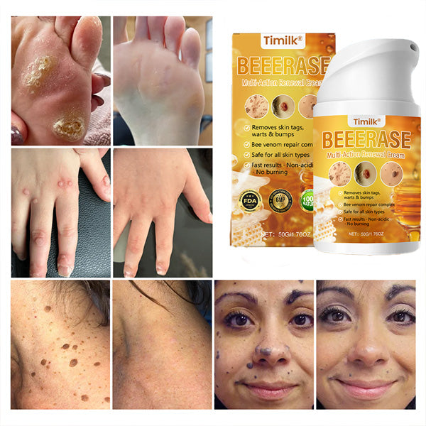 🎅Christmas Hot Sale🔥 BeeErase Multi-Action Renewal Cream