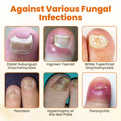 🎅Christmas Hot Sale🔥 FungiBee Advanced Nail Repair Spray