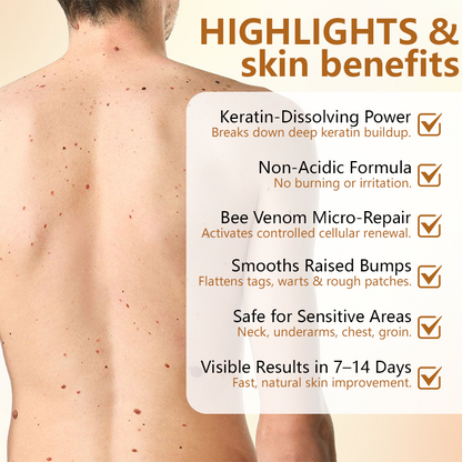 🎅Christmas Hot Sale🔥 BeeErase Multi-Action Renewal Cream