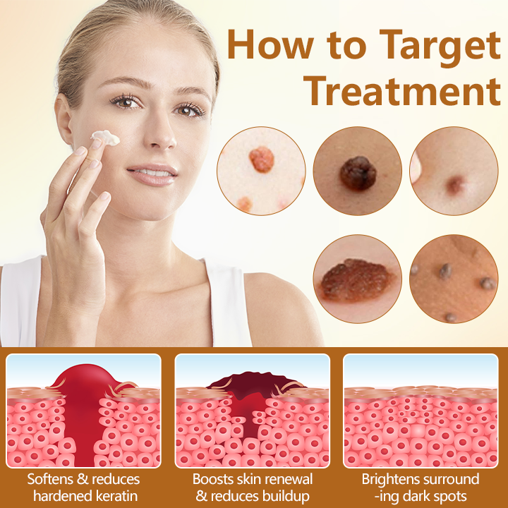 🎅Christmas Hot Sale🔥 BeeErase Multi-Action Renewal Cream