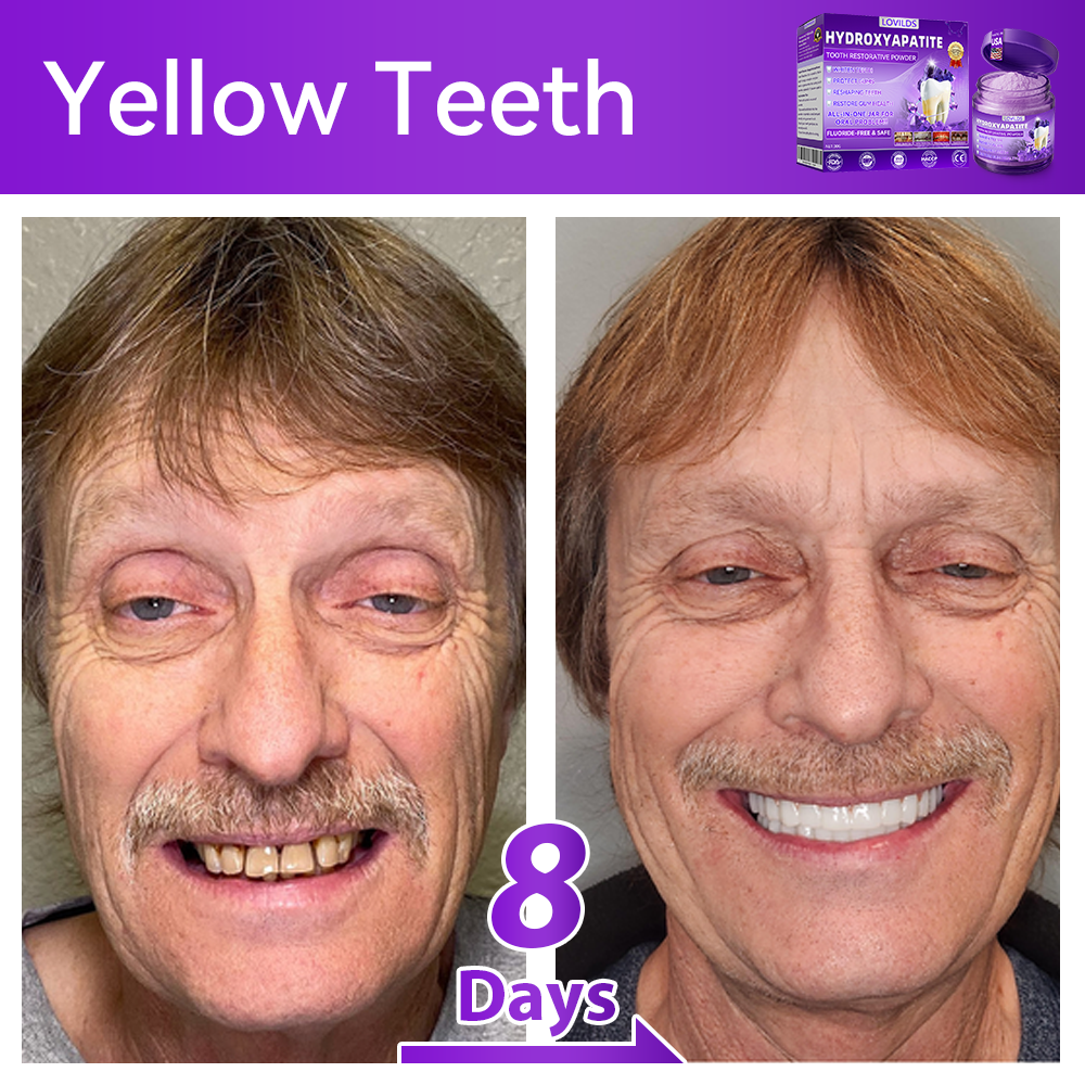 【We take care of your teeth】👨‍🔬𝐻𝑦𝑑𝑟𝑜𝑥𝑦𝑎𝑝𝑎𝑡𝑖𝑡𝑒 𝑇𝑜𝑜𝑡ℎ 𝑅𝑒𝑠𝑡𝑜𝑟𝑎𝑡𝑖𝑣𝑒 𝑃𝑜𝑤𝑑𝑒𝑟 🥇  (effectively repairs cavities, gum issues, tooth sensitivity, mouth ulcers, yellowing teeth, and improves oral health)🦷