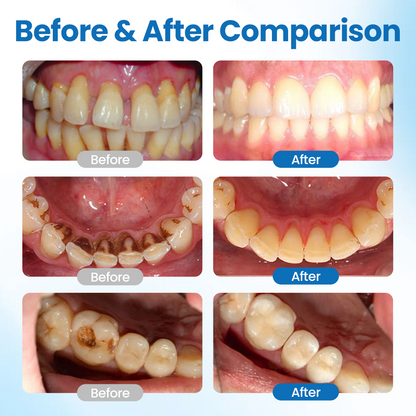 🎅Christmas Hot Sale🔥 NanoHAP Tooth Defense Serum