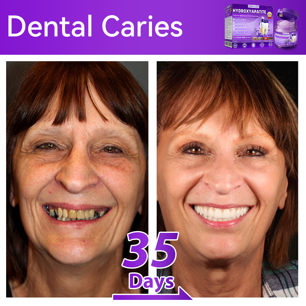 【We take care of your teeth】👨‍🔬𝐻𝑦𝑑𝑟𝑜𝑥𝑦𝑎𝑝𝑎𝑡𝑖𝑡𝑒 𝑇𝑜𝑜𝑡ℎ 𝑅𝑒𝑠𝑡𝑜𝑟𝑎𝑡𝑖𝑣𝑒 𝑃𝑜𝑤𝑑𝑒𝑟 🥇  (effectively repairs cavities, gum issues, tooth sensitivity, mouth ulcers, yellowing teeth, and improves oral health)🦷