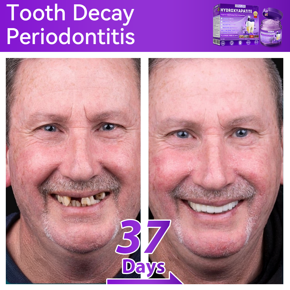 【We take care of your teeth】👨‍🔬𝐻𝑦𝑑𝑟𝑜𝑥𝑦𝑎𝑝𝑎𝑡𝑖𝑡𝑒 𝑇𝑜𝑜𝑡ℎ 𝑅𝑒𝑠𝑡𝑜𝑟𝑎𝑡𝑖𝑣𝑒 𝑃𝑜𝑤𝑑𝑒𝑟 🥇  (effectively repairs cavities, gum issues, tooth sensitivity, mouth ulcers, yellowing teeth, and improves oral health)🦷