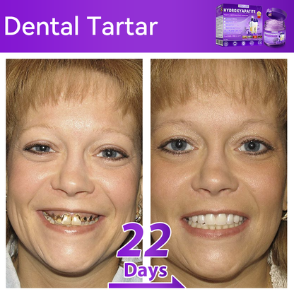 【We take care of your teeth】👨‍🔬𝐻𝑦𝑑𝑟𝑜𝑥𝑦𝑎𝑝𝑎𝑡𝑖𝑡𝑒 𝑇𝑜𝑜𝑡ℎ 𝑅𝑒𝑠𝑡𝑜𝑟𝑎𝑡𝑖𝑣𝑒 𝑃𝑜𝑤𝑑𝑒𝑟 🥇  (effectively repairs cavities, gum issues, tooth sensitivity, mouth ulcers, yellowing teeth, and improves oral health)🦷