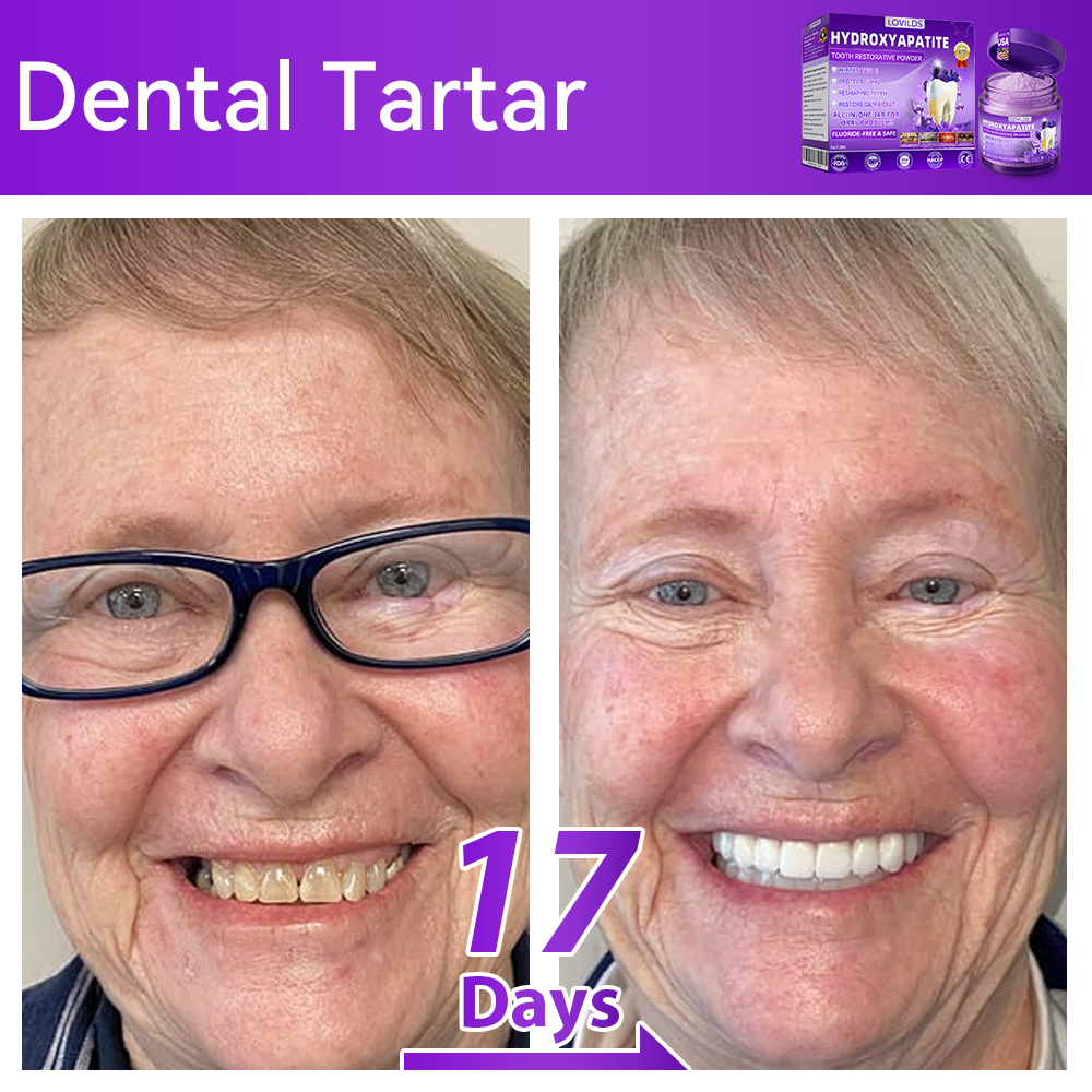 【We take care of your teeth】👨‍🔬𝐻𝑦𝑑𝑟𝑜𝑥𝑦𝑎𝑝𝑎𝑡𝑖𝑡𝑒 𝑇𝑜𝑜𝑡ℎ 𝑅𝑒𝑠𝑡𝑜𝑟𝑎𝑡𝑖𝑣𝑒 𝑃𝑜𝑤𝑑𝑒𝑟 🥇  (effectively repairs cavities, gum issues, tooth sensitivity, mouth ulcers, yellowing teeth, and improves oral health)🦷