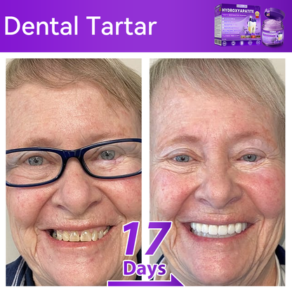 【We take care of your teeth】👨‍🔬𝐻𝑦𝑑𝑟𝑜𝑥𝑦𝑎𝑝𝑎𝑡𝑖𝑡𝑒 𝑇𝑜𝑜𝑡ℎ 𝑅𝑒𝑠𝑡𝑜𝑟𝑎𝑡𝑖𝑣𝑒 𝑃𝑜𝑤𝑑𝑒𝑟 🥇  (effectively repairs cavities, gum issues, tooth sensitivity, mouth ulcers, yellowing teeth, and improves oral health)🦷