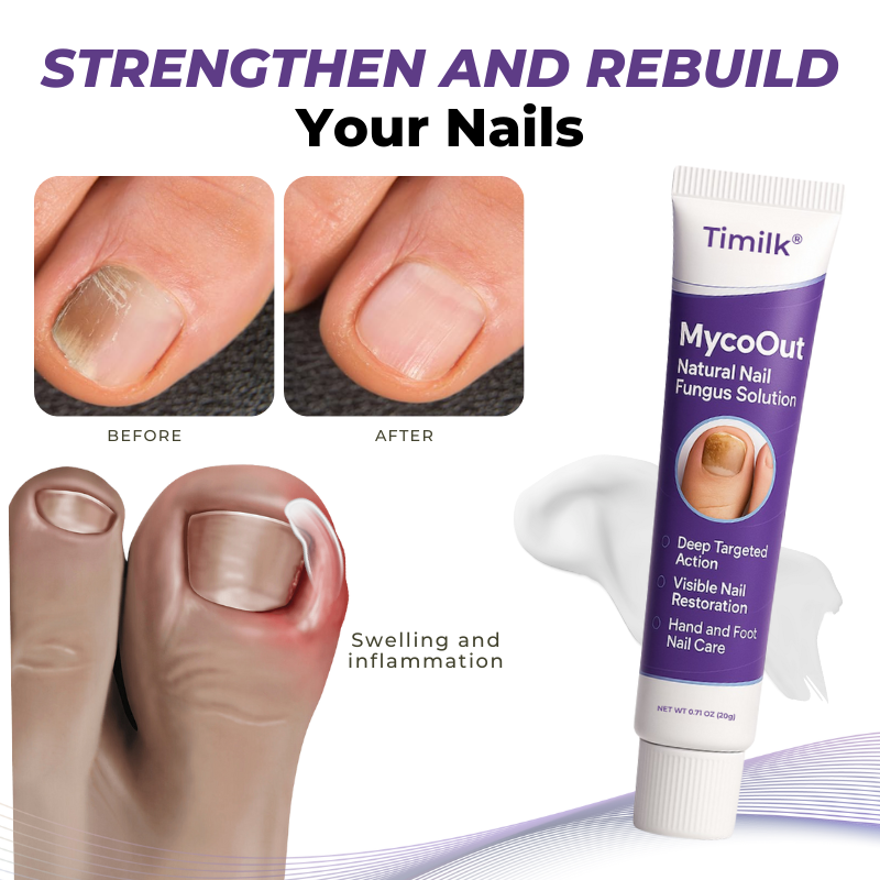 🎅Christmas Hot Sale🔥 MycoOut Natural Nail Fungus Solution