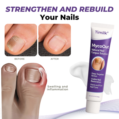 🎅Christmas Hot Sale🔥 MycoOut Natural Nail Fungus Solution
