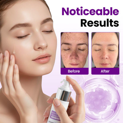 🎅Christmas Hot Sale🔥SpotErase Probiotic Shield Serum