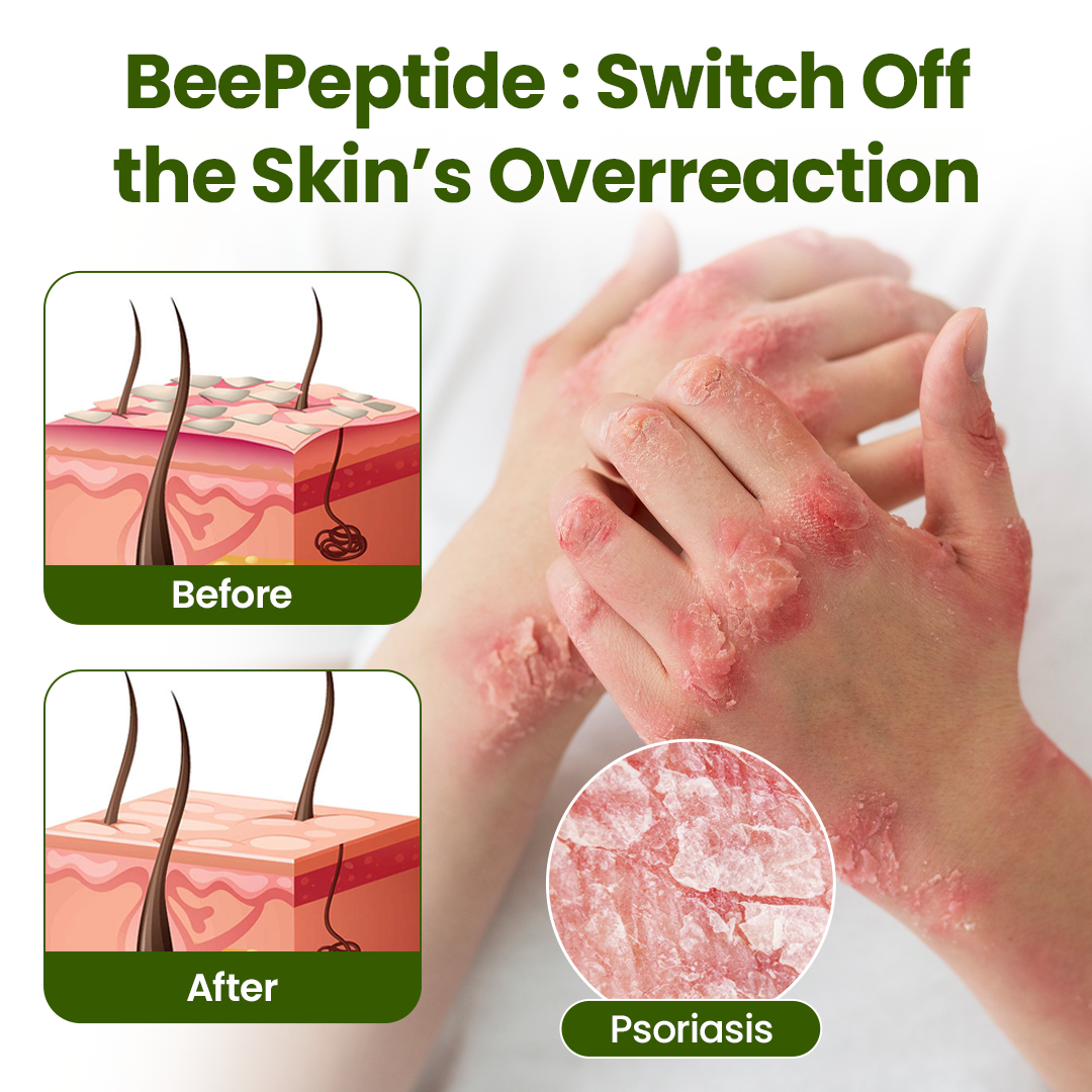 🎅Christmas Hot Sale🔥 BeePeptide RootSoft DualRelief Cream