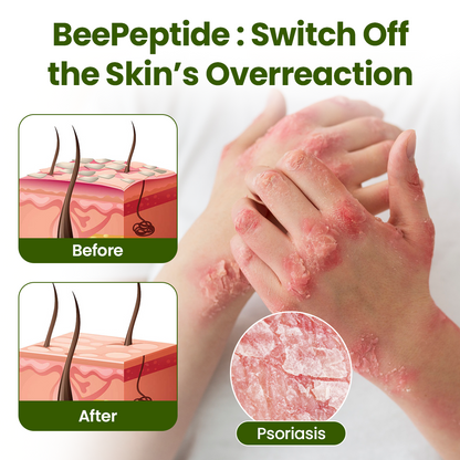 🎅Christmas Hot Sale🔥 BeePeptide RootSoft DualRelief Cream