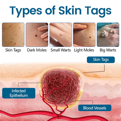 🎅Christmas Hot Sale🔥 DermaVenom RX+ Precision Removal Cream