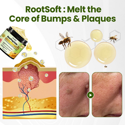 🎅Christmas Hot Sale🔥 BeePeptide RootSoft DualRelief Cream