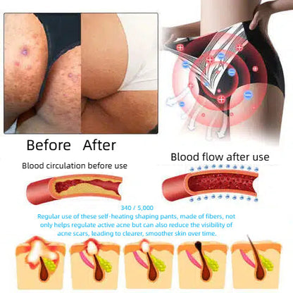 🔥Last day:70% off🏆 Self-regulating tourmaline shaping shorts with titanium fiber