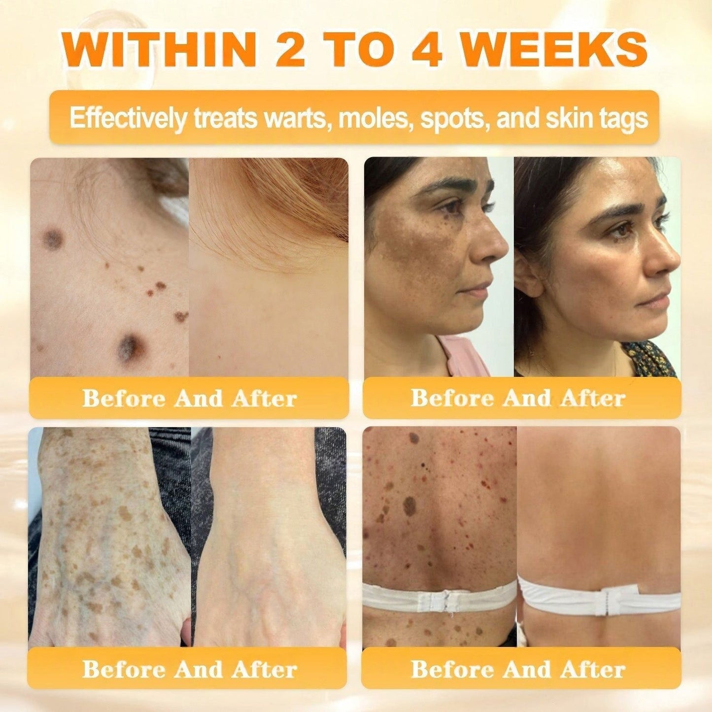 🎅Christmas Hot Sale🔥 BeeErase Multi-Action Renewal Cream