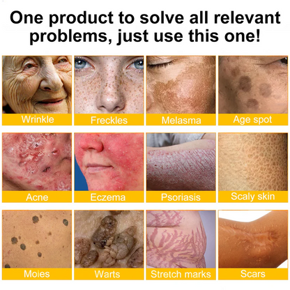 🎅Christmas Hot Sale🔥 BeeErase Multi-Action Renewal Cream