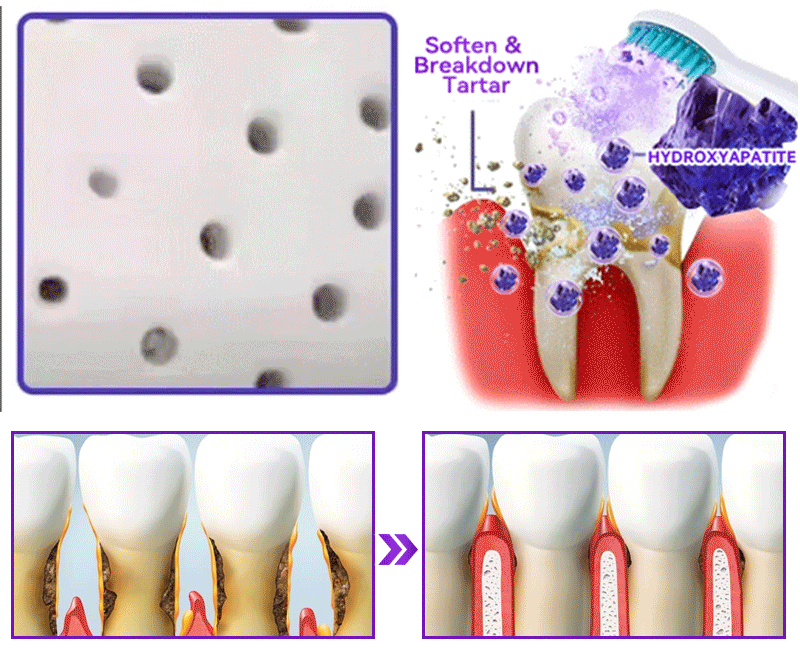 【We take care of your teeth】👨‍🔬𝐻𝑦𝑑𝑟𝑜𝑥𝑦𝑎𝑝𝑎𝑡𝑖𝑡𝑒 𝑇𝑜𝑜𝑡ℎ 𝑅𝑒𝑠𝑡𝑜𝑟𝑎𝑡𝑖𝑣𝑒 𝑃𝑜𝑤𝑑𝑒𝑟 🥇  (effectively repairs cavities, gum issues, tooth sensitivity, mouth ulcers, yellowing teeth, and improves oral health)🦷