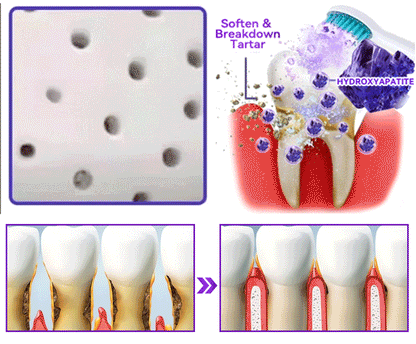 【We take care of your teeth】👨‍🔬𝐻𝑦𝑑𝑟𝑜𝑥𝑦𝑎𝑝𝑎𝑡𝑖𝑡𝑒 𝑇𝑜𝑜𝑡ℎ 𝑅𝑒𝑠𝑡𝑜𝑟𝑎𝑡𝑖𝑣𝑒 𝑃𝑜𝑤𝑑𝑒𝑟 🥇  (effectively repairs cavities, gum issues, tooth sensitivity, mouth ulcers, yellowing teeth, and improves oral health)🦷